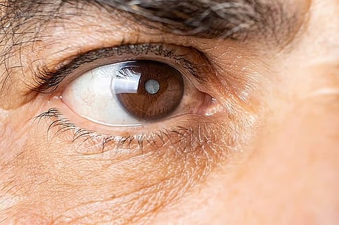 大気汚染で緑内障や白内障のリスクが上昇する可能性