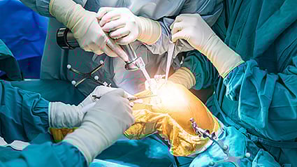 ¿Puedes evitar una cirugía de reemplazo de rodilla mediante ejercicio?