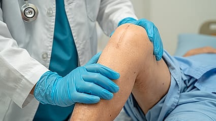 Cirugía de reemplazo de rodilla