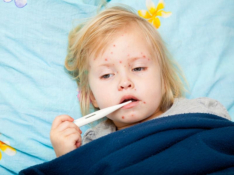 WHO Reports 79% Increase in Measles Cases Worldwide