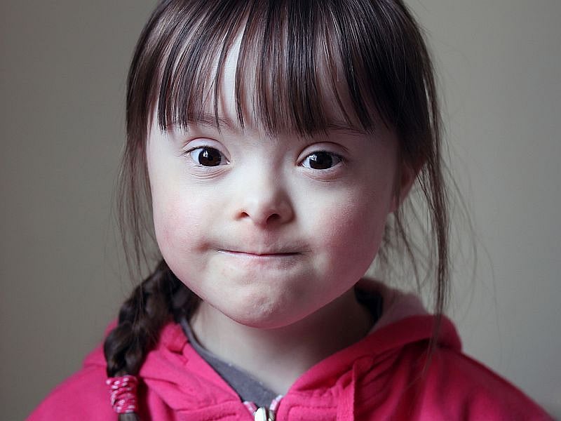 Children With Down Syndrome More Vulnerable to Leukemia