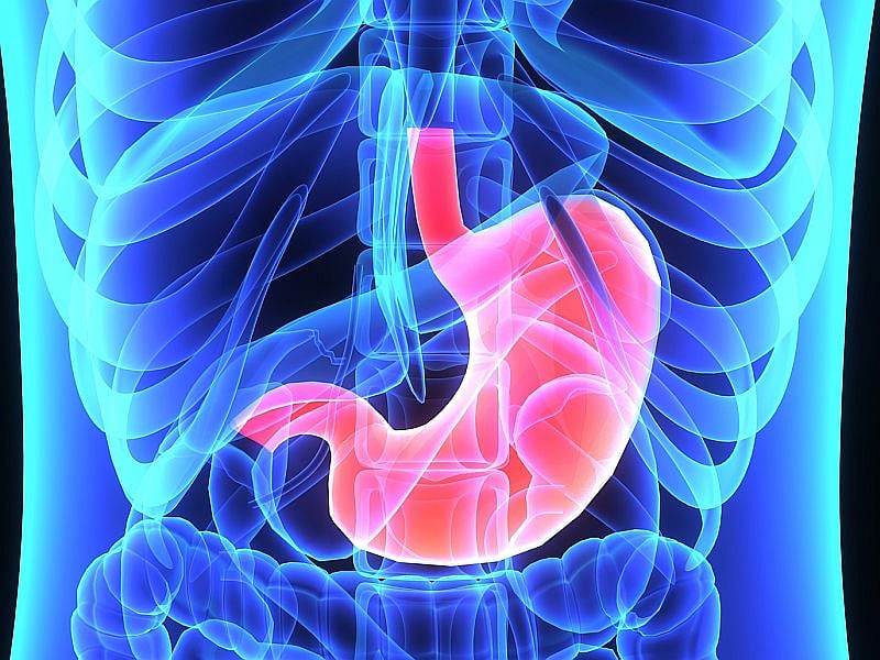 Common Stomach Bug Is Linked to Higher Alzheimer's Risk