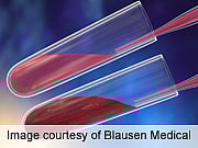 ACS Green Coffee Extract Lowers Blood Glucose Levels