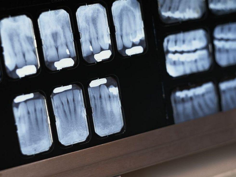 Dental Group Says Lead Aprons No Longer Needed for X-Rays