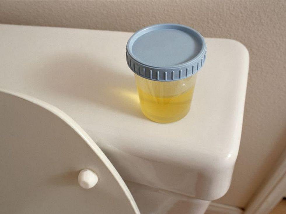 Urine Test Might Spot Head-and-Neck Cancers Early