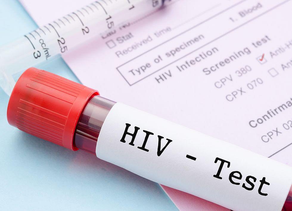 COVID Pandemic Set Back U.S. Efforts to Fight HIV