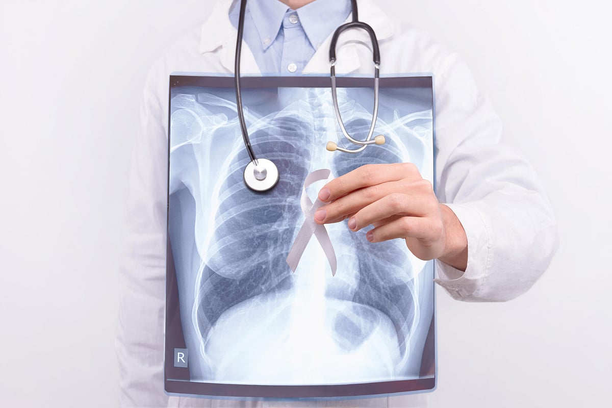 Treatment Approach Effective When Surgery Not an Option for Lung Cancer