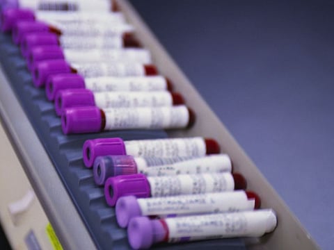 身体活動量や座位行動に関連する複数の代謝物質を同定 －健康な日本人を対象に行ったメタボローム解析から(2016.10.31配信)