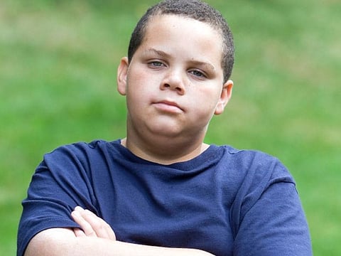 10～17歳の6人に1人が肥満、米調査