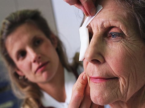 失明につながる「眼の帯状疱疹」が増加、米研究