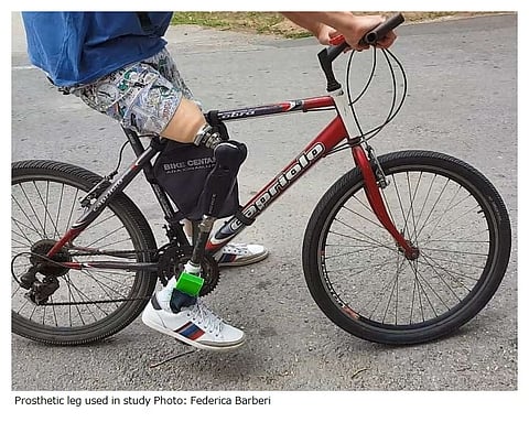 足裏で感じられる義足を開発、「幻肢痛」も軽減