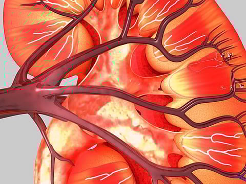 糖尿病性腎臓病の予防には体重管理も大切――日本人対象の縦断研究より