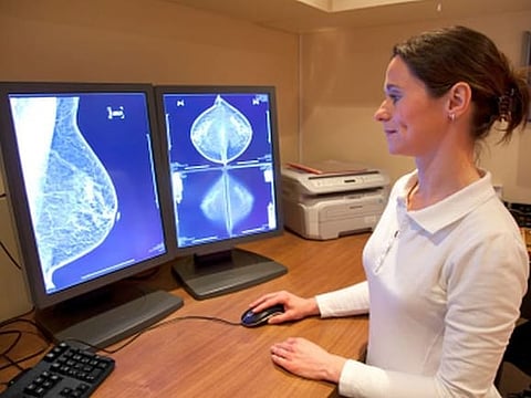 高濃度乳房女性はマンモにMRIを追加すべき？