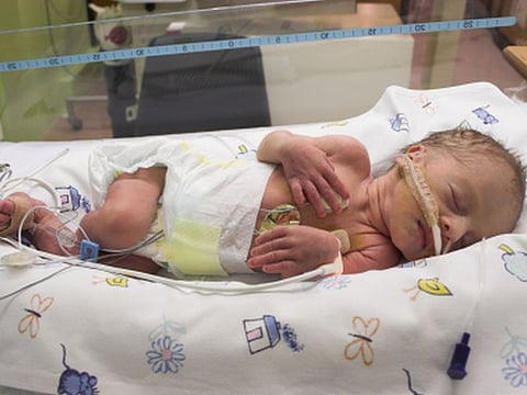 Premature baby sleeping in ICU only one day old