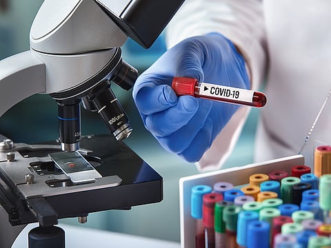 doctor in the laboratory with a blood tube for analysis and sampling of Coronavirus under the microscope / microbiologist with a tube of blood analyzed under a microscope and contaminated by Coronavirus with label covid-19