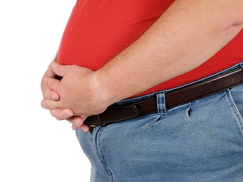 Sehr dicker Mann mit erheblichem Übergewicht präsentiert sich der Kamera
Fat man isolated on white