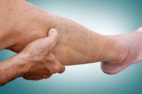 重症下肢虚血に対する血管内治療とバイパス術の予後比較