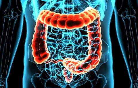 大腸がんリスクの低い人では便検査を用いた3年間隔での大腸がん検診が適切か
