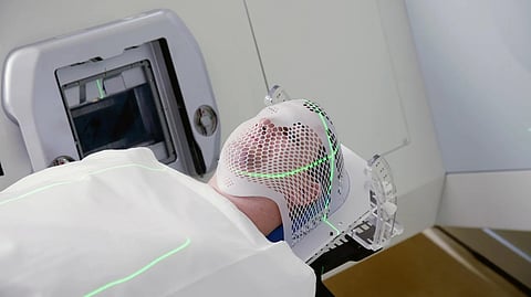 放射線療法を受けたがん患者、精神疾患があると生存率が有意に低下