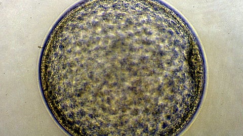 Viikon ikäinen alkio (blastokysti) mikroskooppikuvassa.