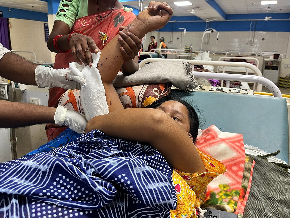 Adivasi woman, at a government hospital in Chhattisgarh after she stepped on an IED planted due to India anti-Naxalite or Mao