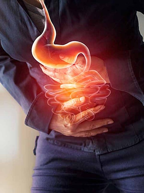 Indigestion - Symptom to Diet