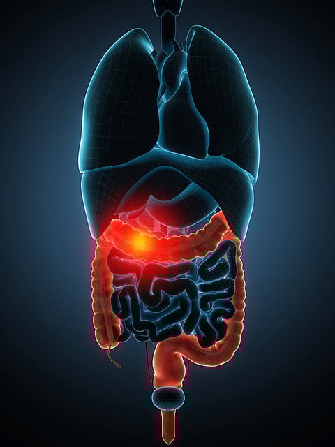 How to prevent ulcers?