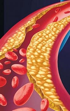 What are the Foods that Reduce Fat?