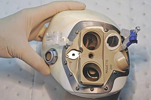 உலகின் முதல் செயற்கை இதய மாற்று அறுவைச் சிகிச்சை: பிரான்ஸ் மருத்துவர்கள் சாதனை