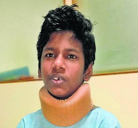 சென்னையில் குண்டடிபட்ட சிறுவனின் உடல்நிலையில் முன்னேற்றம்- தமிழக அரசு உதவியை எதிர்பார்க்கிறது குடும்பம்