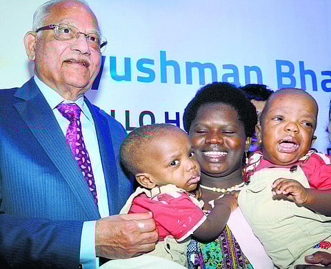 ஒட்டிப்பிறந்த இரட்டை குழந்தைகளுக்கு முதல் பிறந்தநாள்- அப்போலோ மருத்துவமனையில் கொண்டாட்டம்﻿