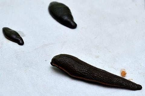 விந்தை உயிரிகள்: ரத்தம் உறிஞ்சும் அட்டைகள்﻿