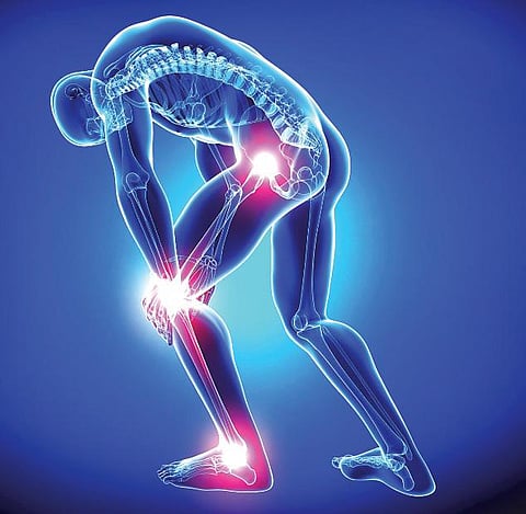 மூட்டு வலி: முதலுக்கே மோசம் - உலக ஆர்த்ரைட்டிஸ் நாள் அக்டோபர் 12