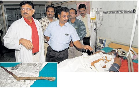 லாரி ஓட்டுநர் மார்பைத் துளைத்த﻿ 2 அடி நீளமுள்ள சவுக்குக் கம்பு அறுவை சிகிச்சையில் அகற்றம்﻿: வேலூரில் அரசு மருத்துவர்கள் சாதனை﻿