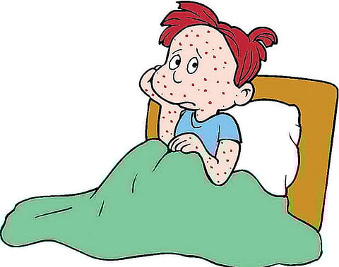 மறைந்திருந்து தாக்கும் அக்கி