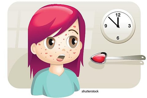 கோடைக்கு முன் பரவும் அம்மை: பாதுகாப்பு வழிகள்