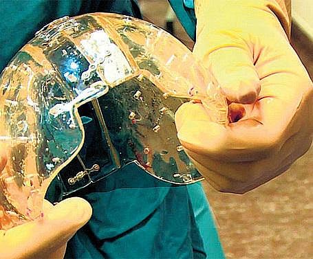 3டி மருத்துவ அறிக்கை