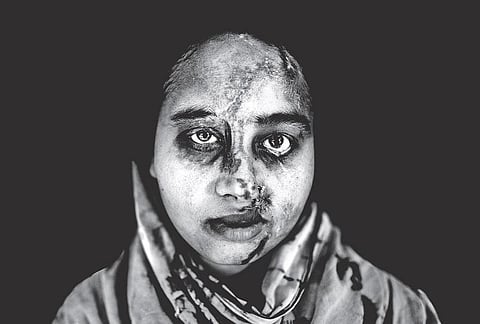 அமில அரக்கன்