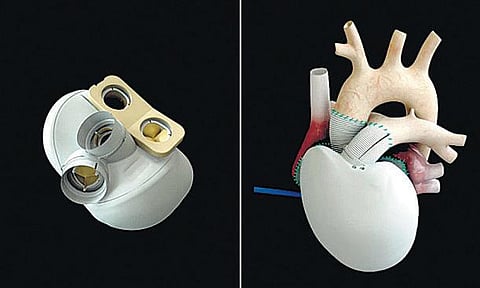 செயற்கை இதயம்