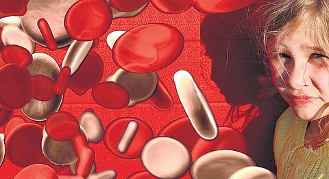 உடல் சக்தியைப் பறிக்கும் நோய் | சர்வதேச தாலசீமியா நாள் : மே 8