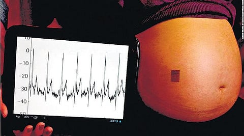 பயோ ஸ்டாம்ப்