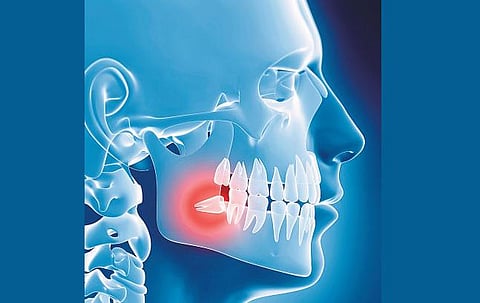 பற்கள் உடைந்து போவது ஏன்?