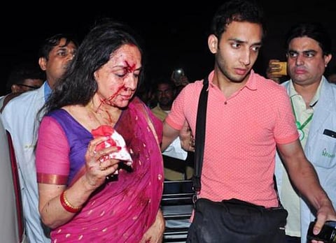 சாலை விபத்தில் குழந்தை பலி, ஹேமா மாலினி காயம்: கார் ஓட்டுநர் கைது