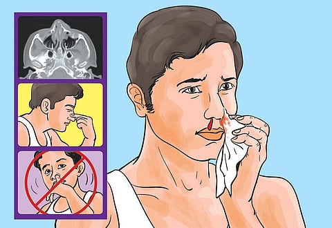 மூக்கில் ரத்தம் வடிவது ஏன்?﻿