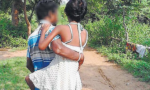 பலாத்காரத்தால் பாதிக்கப்பட்ட மகளை சிகிச்சைக்கு 4 கி.மீ. தூக்கிச் செல்லும் தந்தை﻿