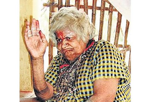 மூதாட்டியை ஜீவசமாதி வைக்க முயன்றதாக புகார்﻿: அதிகாரிகள் மீட்டு சிகிச்சை﻿