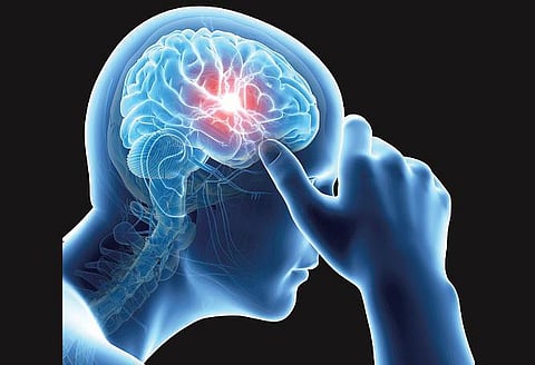 மூளையைக் காப்போம், பக்கவாதம் தடுப்போம்﻿