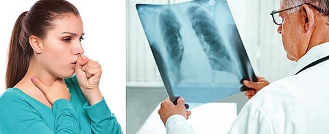 பரிசோதனை ரகசியங்கள் 14: காசநோய்க்கு என்ன பரிசோதனை?﻿