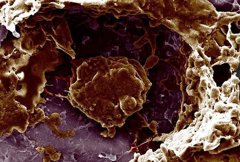 அனைத்து வகை புற்றுநோய்களை எதிர்க்கும் புதிய சிகிச்சை முறை: ஜெர்மனி ஆய்வாளர்கள் சோதனை