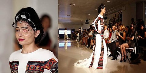 அமெரிக்க ஃபேஷன் ஷோவில் கவனம் ஈர்த்த ஆசிட் வீச்சில் மீண்ட இந்தியப் பெண்!